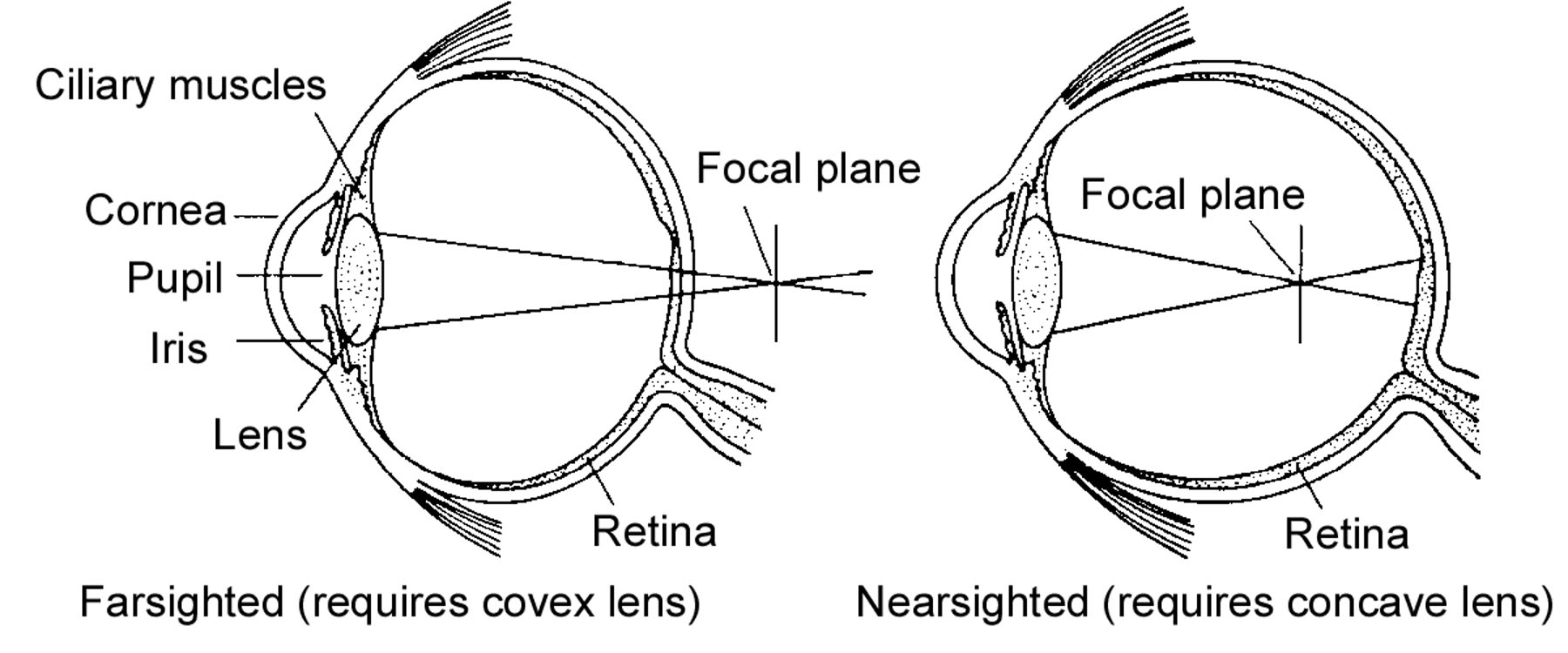 lens shown bending light